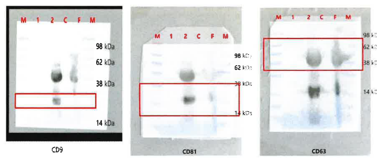 Original Western blot panels labelled CD9, CD81 and CD63